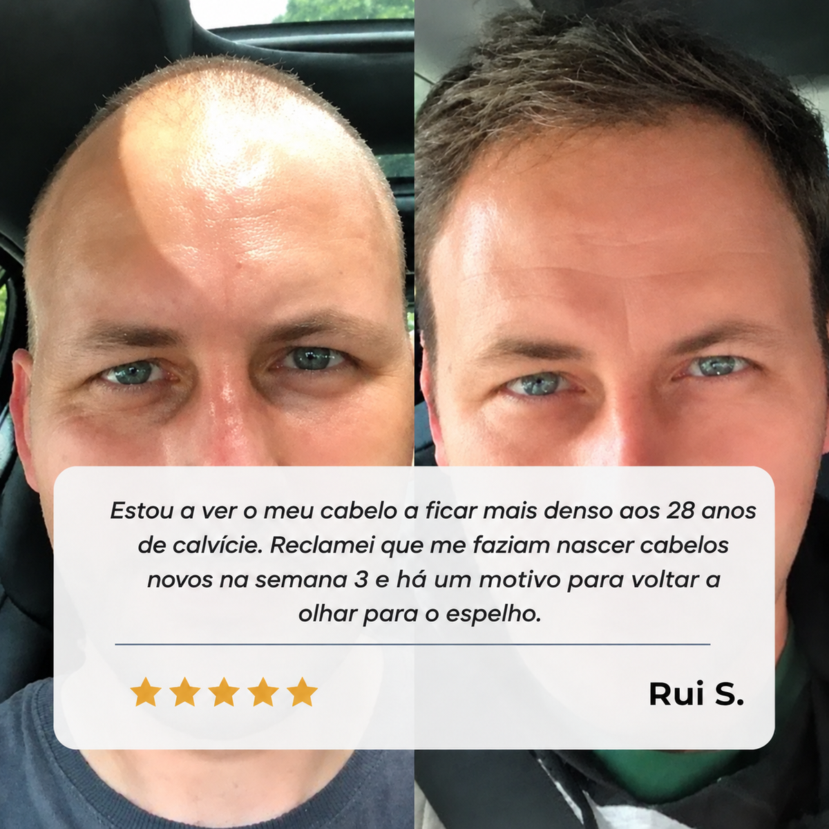 Sérum Roll-on para o Crescimento do Cabelo