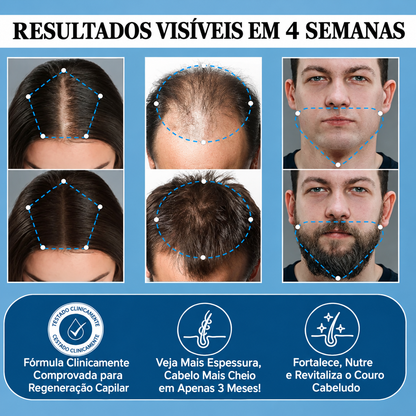 Sérum Roll-on para o Crescimento do Cabelo