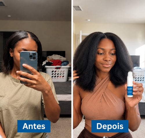 Antes e depois