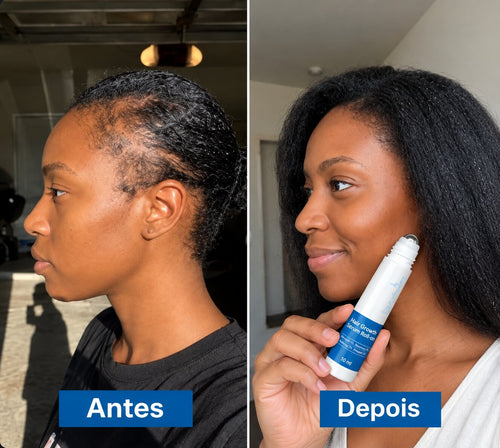 Antes e depois